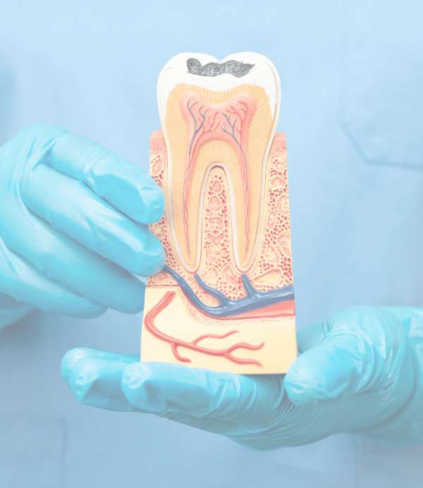 Treatment - Hazelwood Dental