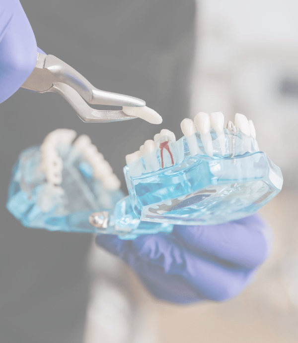 Treatment - Hazelwood Dental