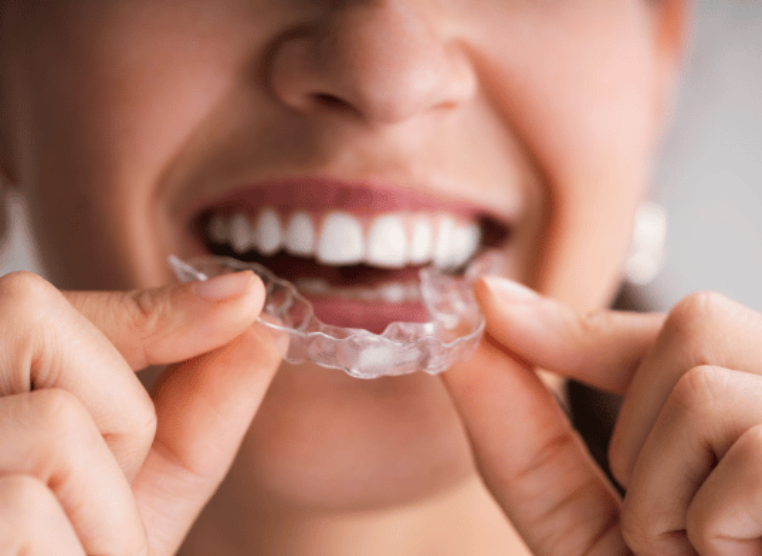 Hazelwood Dental Treatment Journey Image