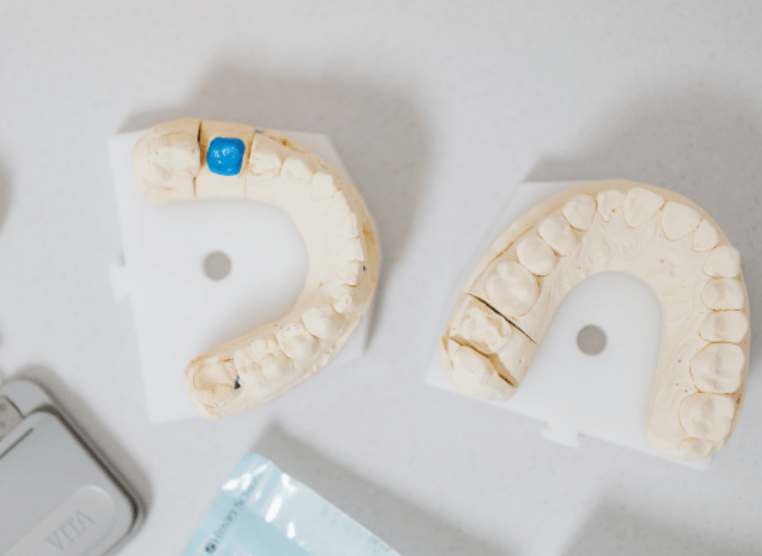 Hazelwood Dental Treatment Journey Image